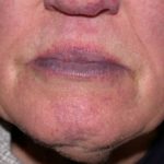 048-cyanosis__protectwyjqcm90zwn0il0_focusfillwzi5ncwymjisingildfd-6780694-7848794-jpg-4261421