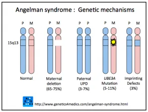 Genetica della sindrome di Angelman