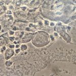 aerobic-vaginitis__protectwyjqcm90zwn0il0_focusfillwzi5ncwymjisinkildm2xq-8954384-5182213-jpg-9168311