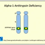Alpha-1-Antitrypsin-Mangel3__protectwyjqcm90zwn0il0_focusfillwzi5ncwymjisingildfd-3271148-5748744-png-8008890