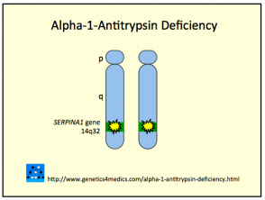 Alpha 1 Antitrypsin-Mangel