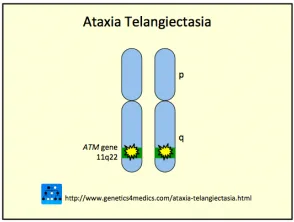 atassia-telangiectasia__protectwyjqcm90zwn0il0_focusfillwzi5ncwymjisingildjd-3004865-8222161-png-7924037