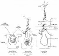 Australische Qualle sticht Nematozystenfigur