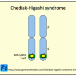 chediak-higashi-syndrome__protectwyjqcm90zwn0il0_focusfillwzi5ncwymjisingildfd-2107653-5230154-png-7662439