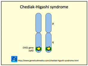 Síndrome de Chediak Higashi
