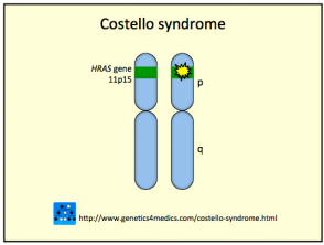 Síndrome de Costello