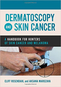 Dermatoscopia de cáncer de piel