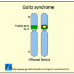 focal-dermal-hypoplasia__protectwyjqcm90zwn0il0_focusfillwzi5ncwymjisingildfd-2206274-5348878-png-8576001