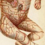 harlequin-fetus__protectwyjqcm90zwn0il0_focusfillwzi5ncwymjisinkildm4nl0-4651350-1825301-jpg-6121578