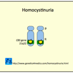 homocystinuria2__protectwyjqcm90zwn0il0_focusfillwzi5ncwymjisingildfd-7069562-1240319-png-4542599