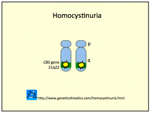 Homocistinuria2