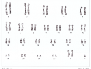 human-chromosomesxxy01__protectwyjqcm90zwn0il0_focusfillwzi5ncwymjisinkildnd-8999355-5025102-png-9961193
