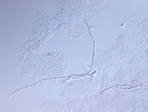 Microscopía KOH de dermatofito