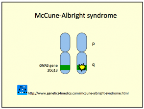 Síndrome de McCune Albright
