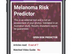 Risicovoorspeller voor melanoom in de Miiskin-app