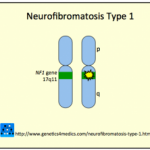 neurofibromatosis-type-1__protectwyjqcm90zwn0il0_focusfillwzi5ncwymjisingildjd-4533007-4043840-png-5635099