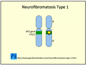 Neurofibromatosis tipo 1