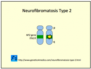 Neurofibromatosis tipo 2