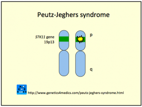 Síndrome de Peutz Jeghers