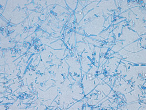 Microscopía de dermatofitos