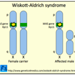 wiskott-aldrich-syndrome-__protectwyjqcm90zwn0il0_focusfillwzi5ncwymjisingildfd-9943667-9878679-png-7963507