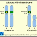 wiskott-aldrich-syndrome-__protectwyjqcm90zwn0il0_focusfillwzi5ncwymjisingildfd-9943667-9878679-png-7963507