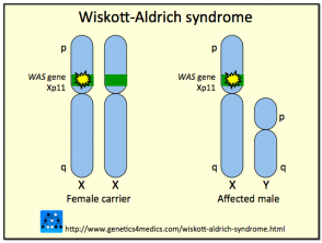Síndrome de Wiskott Aldrich 