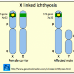 x-linked-ichthyosis__protectwyjqcm90zwn0il0_focusfillwzi5ncwymjisingildfd-5714293-5037855-png-2131065