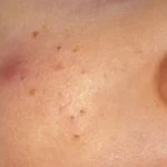 acne-infant__protectwyjqcm90zwn0il0_focusfillwzi5ncwymjisinkildm2xq-7147953-3154987-jpg-9878087