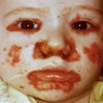 acrfac__protectwyjqcm90zwn0il0_focusfillwzi5ncwymjisingildfd-8459016-8282470-jpg-1536162