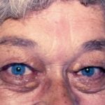 acromegaly1__protectwyjqcm90zwn0il0_focusfillwzi5ncwymjisingildfd-2591684-8647073-jpg-5983659