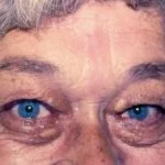 acromegaly1__protectwyjqcm90zwn0il0_focusfillwzi5ncwymjisingildfd-2591684-8647073-jpg-5983659