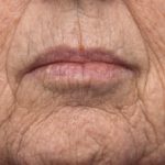 ageing-skin-002__protectwyjqcm90zwn0il0_focusfillwzi5ncwymjisingilde5xq-8140454-9796754-jpg-3044417