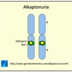 alkaptonuria__protectwyjqcm90zwn0il0_focusfillwzi5ncwymjisingildfd-7801369-6081180-png-9055527