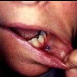 amalgam-tattoo-1__protectwyjqcm90zwn0il0_focusfillwzi5ncwymjisinkildbd-7208280-9845625-jpg-5549119