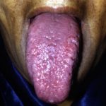 amyl1__protectwyjqcm90zwn0il0_focusfillwzi5ncwymjisingildfd-2807199-2646027-jpg-9801370