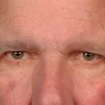 apocrine-chromhidrosis-01__protectwyjqcm90zwn0il0_focusfillwzi5ncwymjisingildfd-4552579-8874737-jpg-4401983