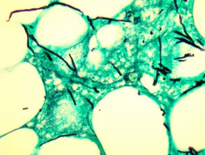 Aspergillus GMS-kleuring