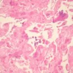 aspergillus-figure-1__protectwyjqcm90zwn0il0_focusfillwzi5ncwymjisingildfd-5467470-9443322-jpg-8970185
