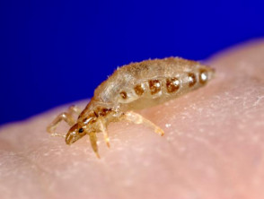 body-louse__protectwyjqcm90zwn0il0_focusfillwzi5ncwymjisingilde4xq-1549590-7618095-jpg-6090634