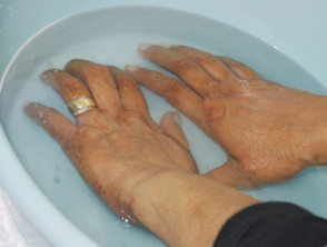 Baño de PUVA para manos y pies