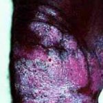 chrobla__protectwyjqcm90zwn0il0_focusfillwzi5ncwymjisinkildezn10-3901781-1298816-jpg-2981887
