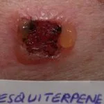 compositae-patch1__protectwyjqcm90zwn0il0_focusfillwzi5ncwymjisingildfd-4336915-7079366-jpg-1746251