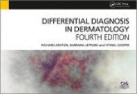 diagnosi differenziale dermatologia richard ashton