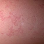 e-marginatum1__protectwyjqcm90zwn0il0_focusfillwzi5ncwymjisingildfd-3239883-6477002-jpg-7655168