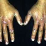 eba1__protectwyjqcm90zwn0il0_focusfillwzi5ncwymjisingildhd-3508997-7766815-jpg-4242545