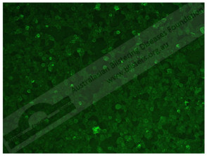 Epidermólisis ampollosa adquirida inmunofluorescencia indirecta