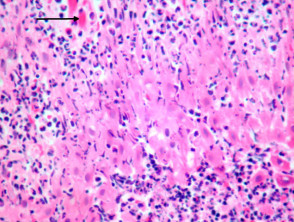 Geflügelpocken Pathologie