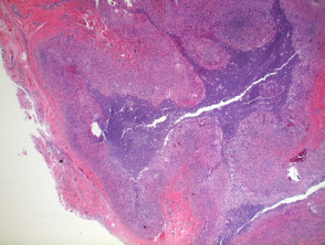 figure1phaeohyphomycosis__protectwyjqcm90zwn0il0_focusfillwzi5ncwymjisingildfd-7289189-5110793-jpg-2368593