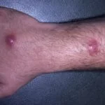 aquarium-granuloma-2-v2__protectwyjqcm90zwn0il0_focusfillwzi5ncwymjisingildfd-8621620-8638472-jpg-2583070